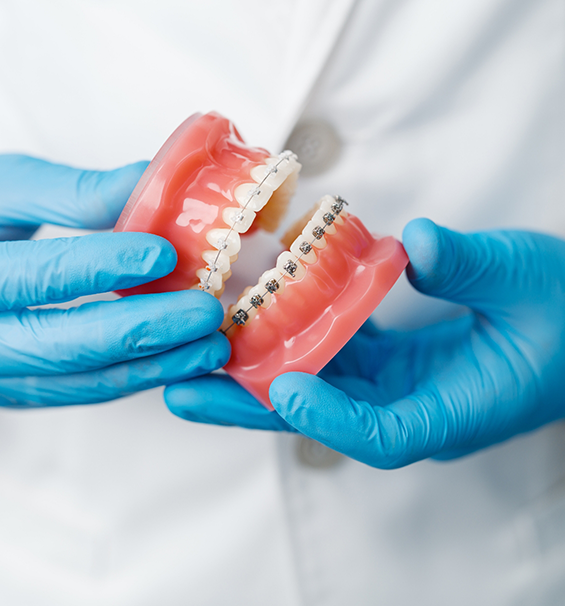 Dentist holding a model of the teeth with braces