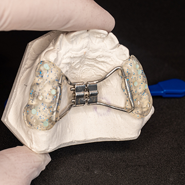 Dentist holding a model of the upper jaw with a palatal expander